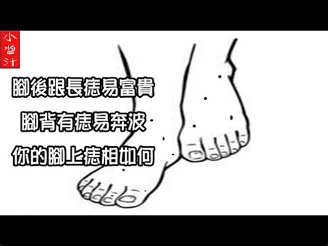 右腳側有痣|非富即貴！5種腳相註定好命 痣長在這裡「天生帝王命。